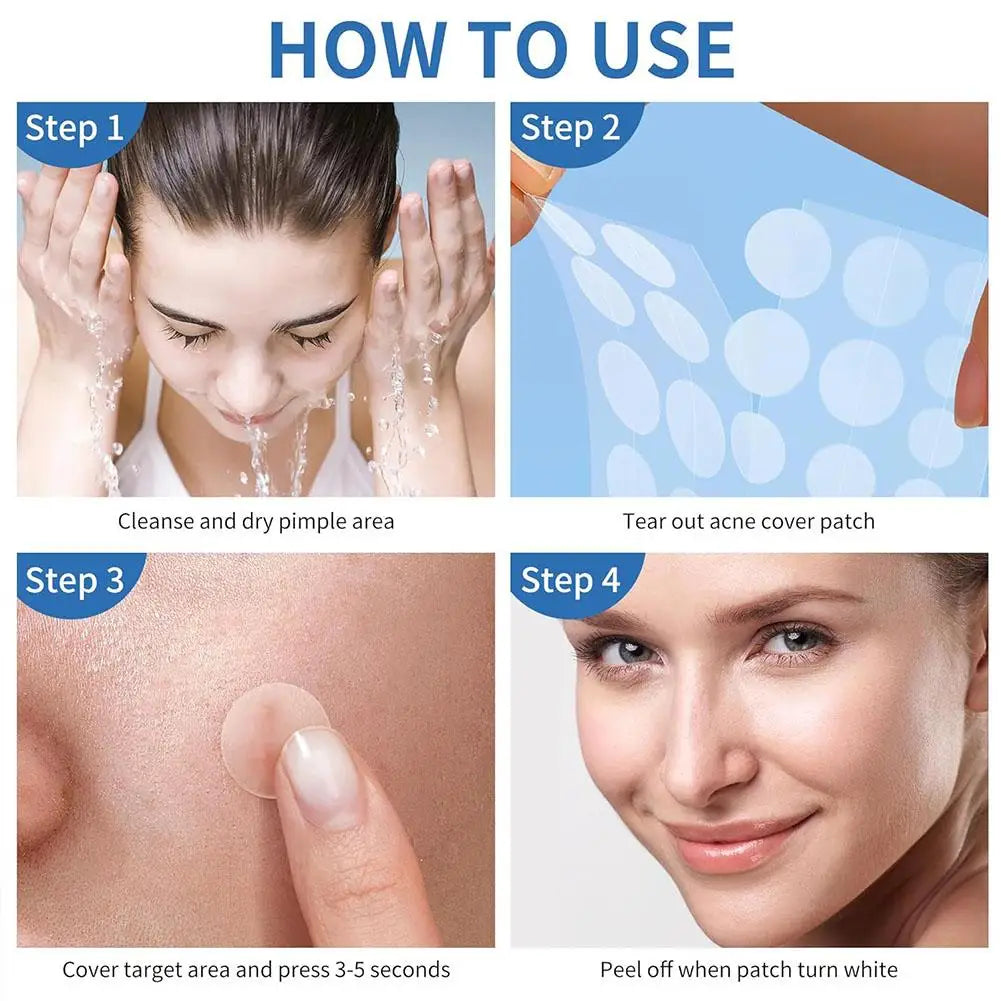 200/262/360pcs Salicylic Acid Acne Patches Mild Non-irritating Fade Black Acne Marks Facial Care Patches Acne Closure Removal