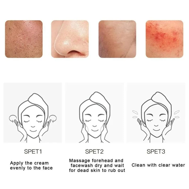 Fruit Acid Peeling Gel for Deep Pore Cleansing - Salon-Quality Skincare Scrubs Treatments Tidesmit