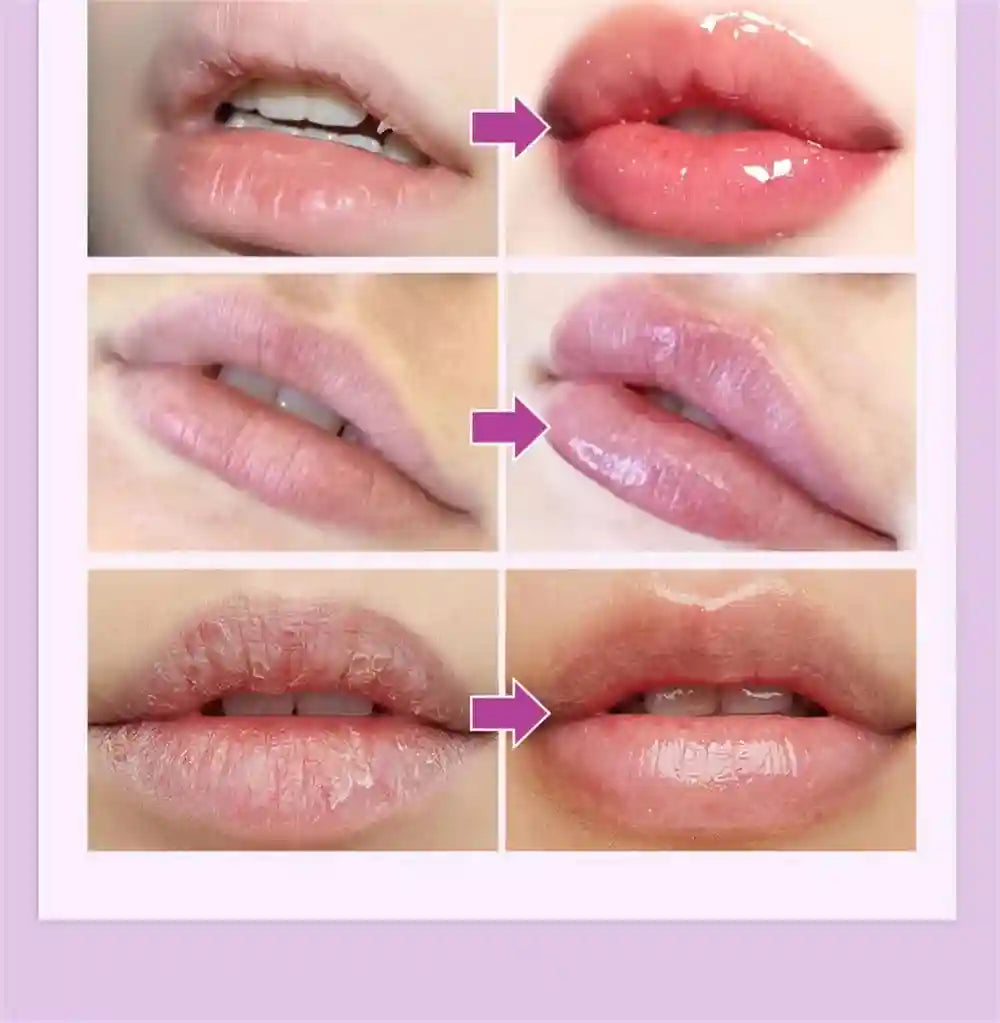 Lip Lightening Balm - Exfoliating Moisturizer for Dark Lips | Tidesmit Lip Care Tidesmit
