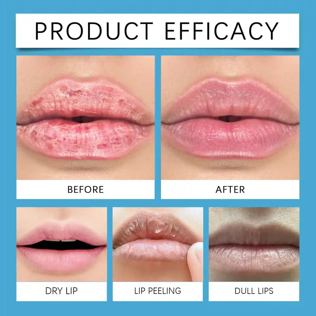 Lip Plumper Serum | Volumizing Lip Treatment for Hydrated Lips Lip Care Tidesmit