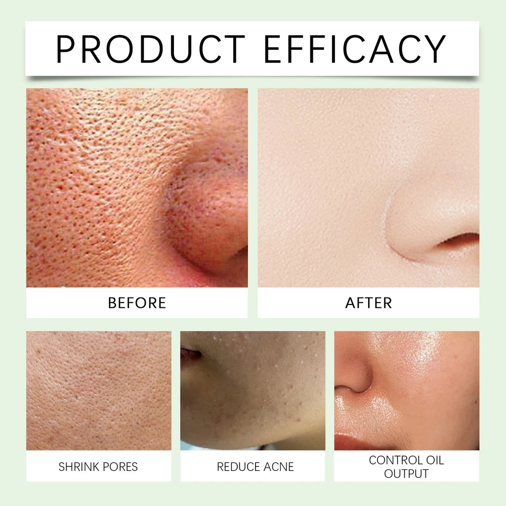 Exfoliating Gel for Pores - Professional Blackhead Removal Scrub Scrubs Treatments Tidesmit