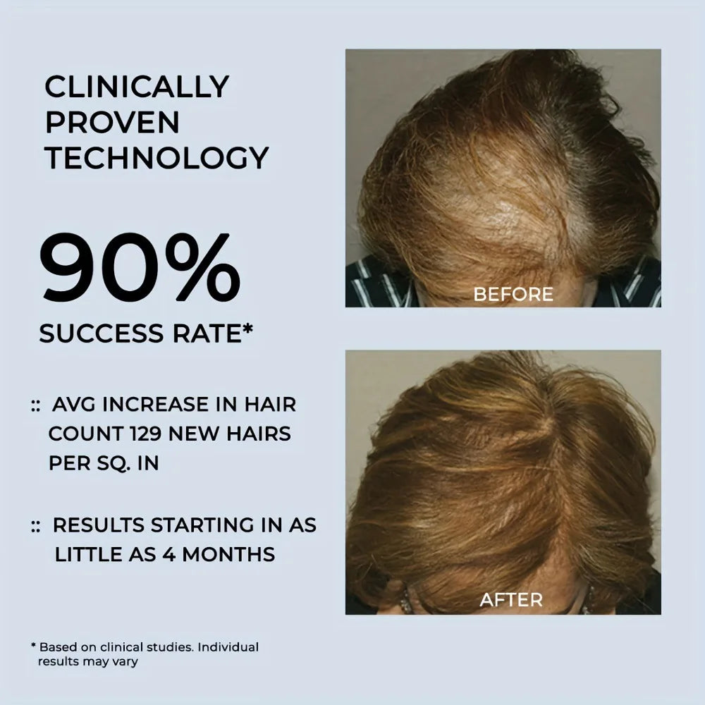Before and after hair growth results using red light therapy cap for hair loss treatment and scalp health improvement.