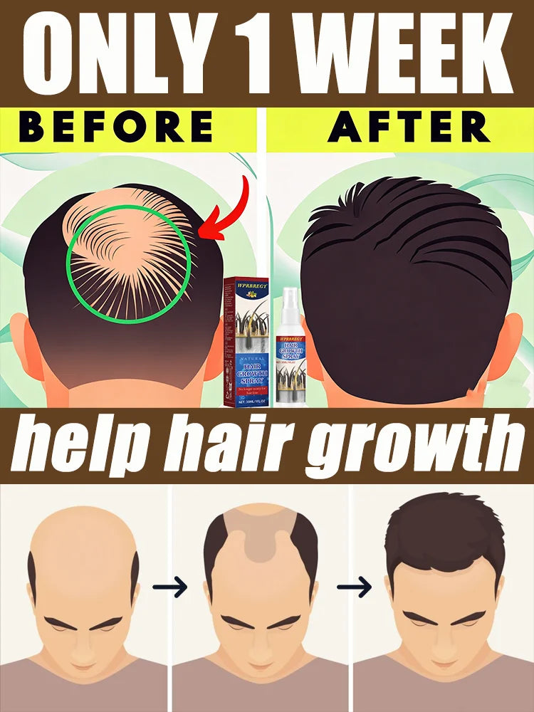 Ginger Hair Growth Spray for Scalp Nourishment and Root Strength Relaxation Treatment Pack of 1Pcs Tidesmit