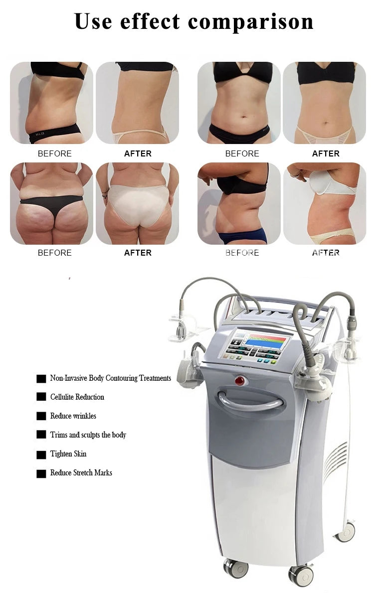 Body Slimming Machine for Cellulite Reduction and Skin Tightening Back Massage Instrument Tidesmit