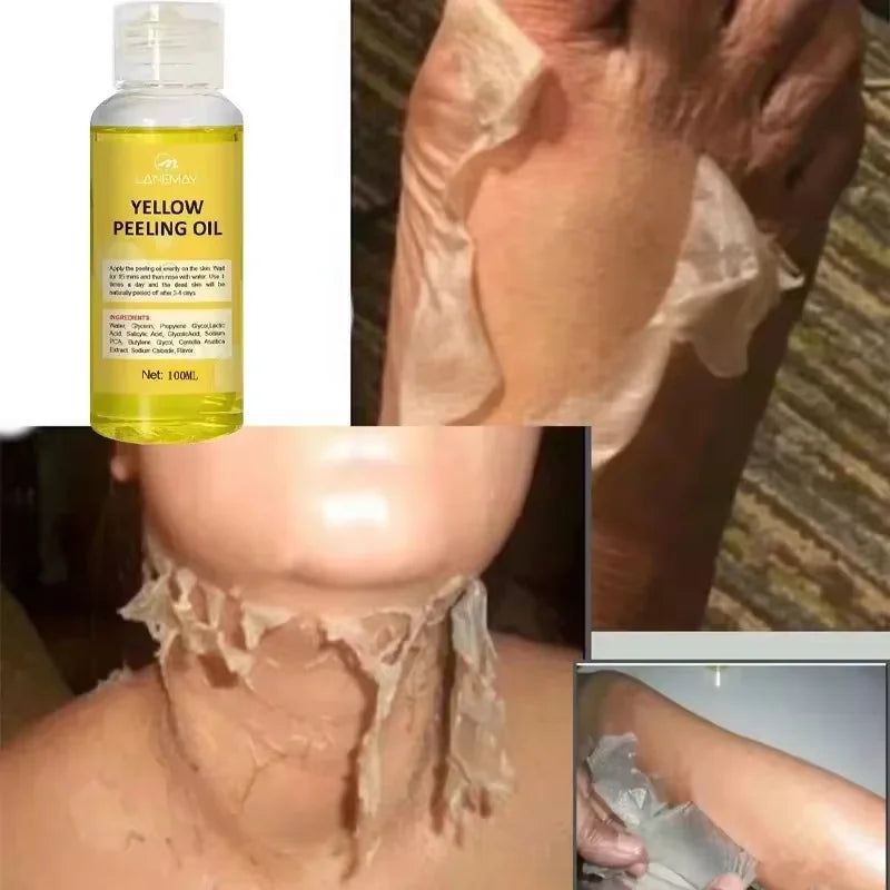 Yellow Peeling Oil for Body Exfoliation - Professional Brightening Serum Scrubs Treatments Tidesmit
