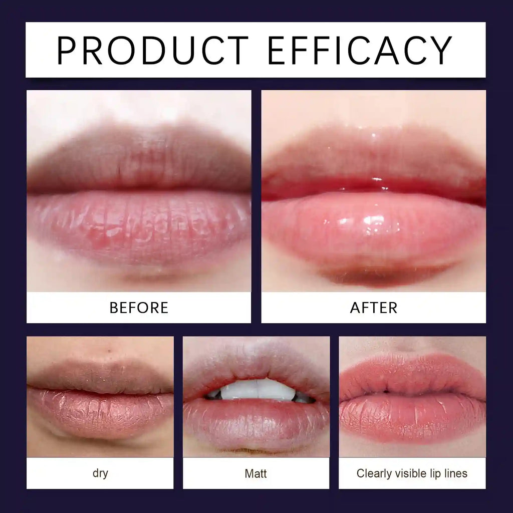Lip Moisturizing Essence: Hydrating Treatment for Smoother Lips Lip Care Tidesmit