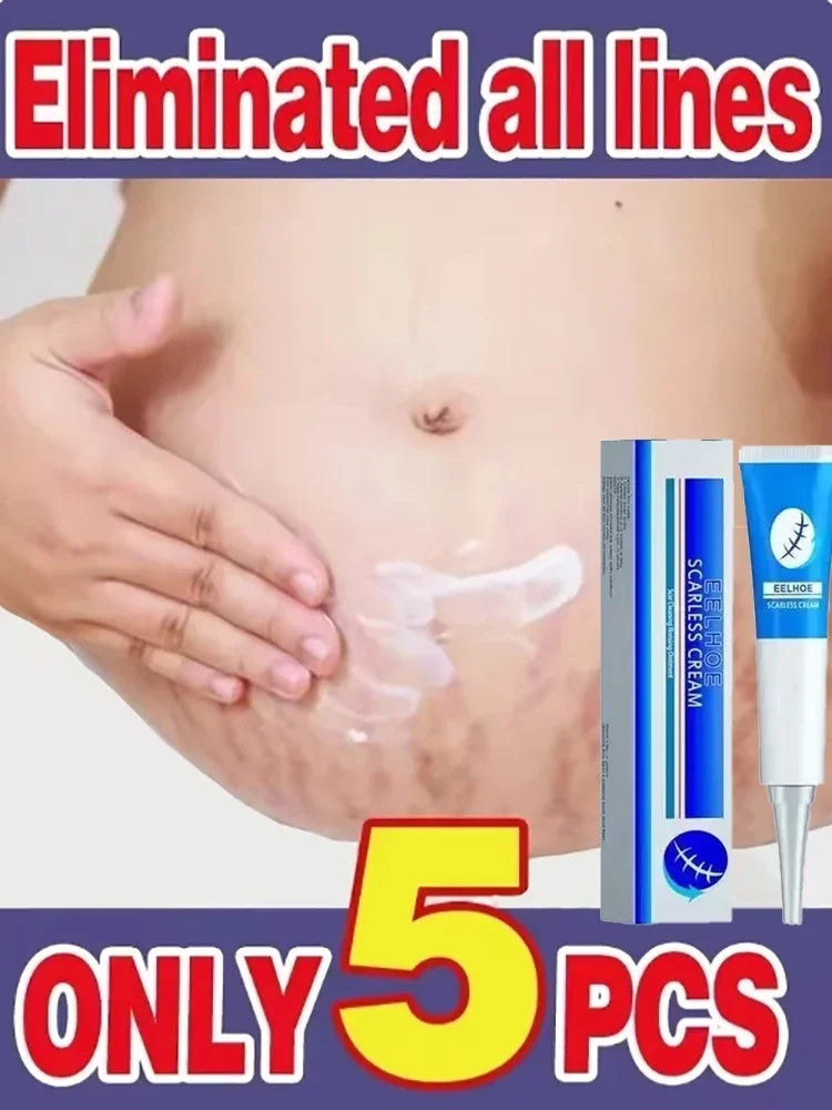 Stretch Mark Repair Cream for Pregnancy Postpartum Skin Recovery Relaxation Treatment Tidesmit
