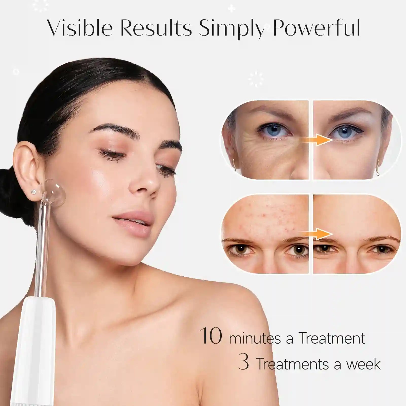 High Frequency Facial Machine - 6-in-1 Professional Skin Therapy Wand Eye Massage Instrument Tidesmit
