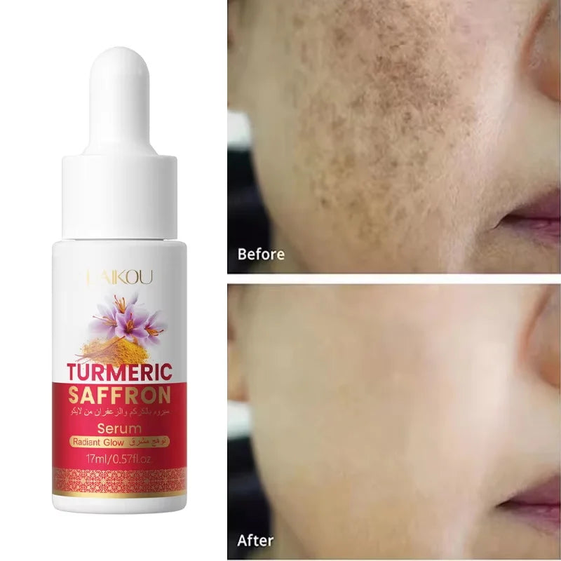 Turmeric Freckle Removing Whitening Essence Fade Pigmentation Melasma Dark Spots Corrector Repair Serum Korean Skin Care