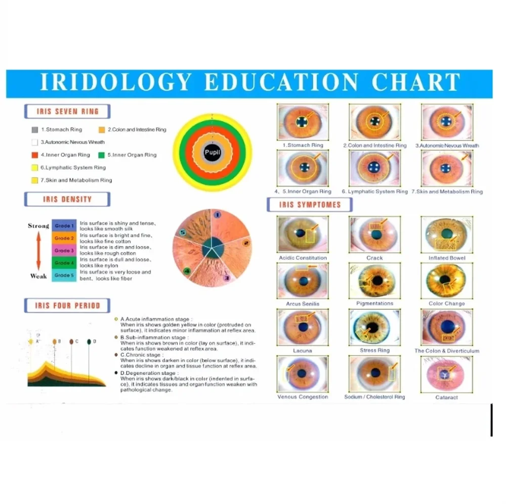 Iris Analyzer System - 12MP Wireless Digital Iridology Health Tool Body Shaping Massage Equipment Tidesmit