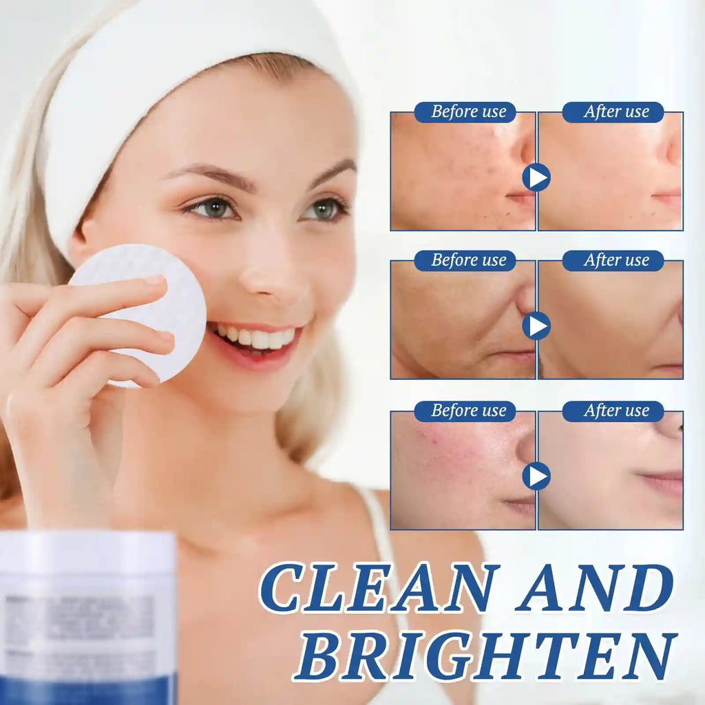Tidesmit Black Facial Cleansing Pads - Exfoliating Face Scrub Kit Scrubs Treatments Tidesmit
