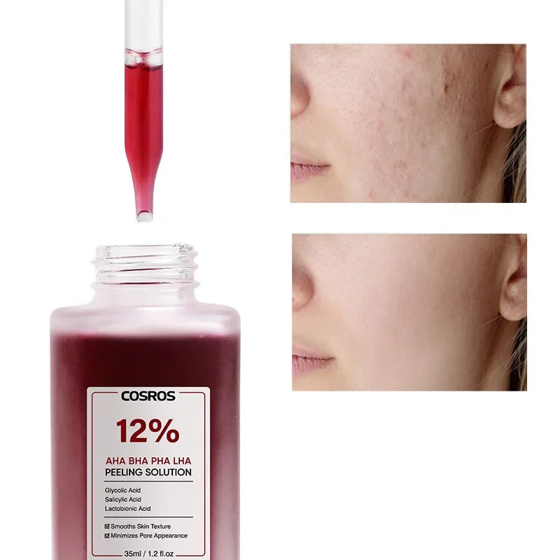 12% AHA BHA PHA LHA peeling solution in a 35ml frosted bottle, shown with a red dropper and skin texture comparison.
