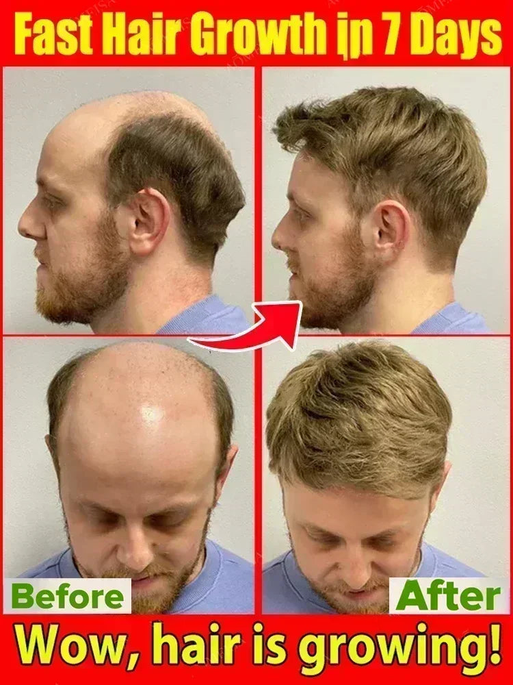 Hair Growth Treatment | Nourishing Scalp Serum for Natural Regrowth Scrubs Treatments Tidesmit