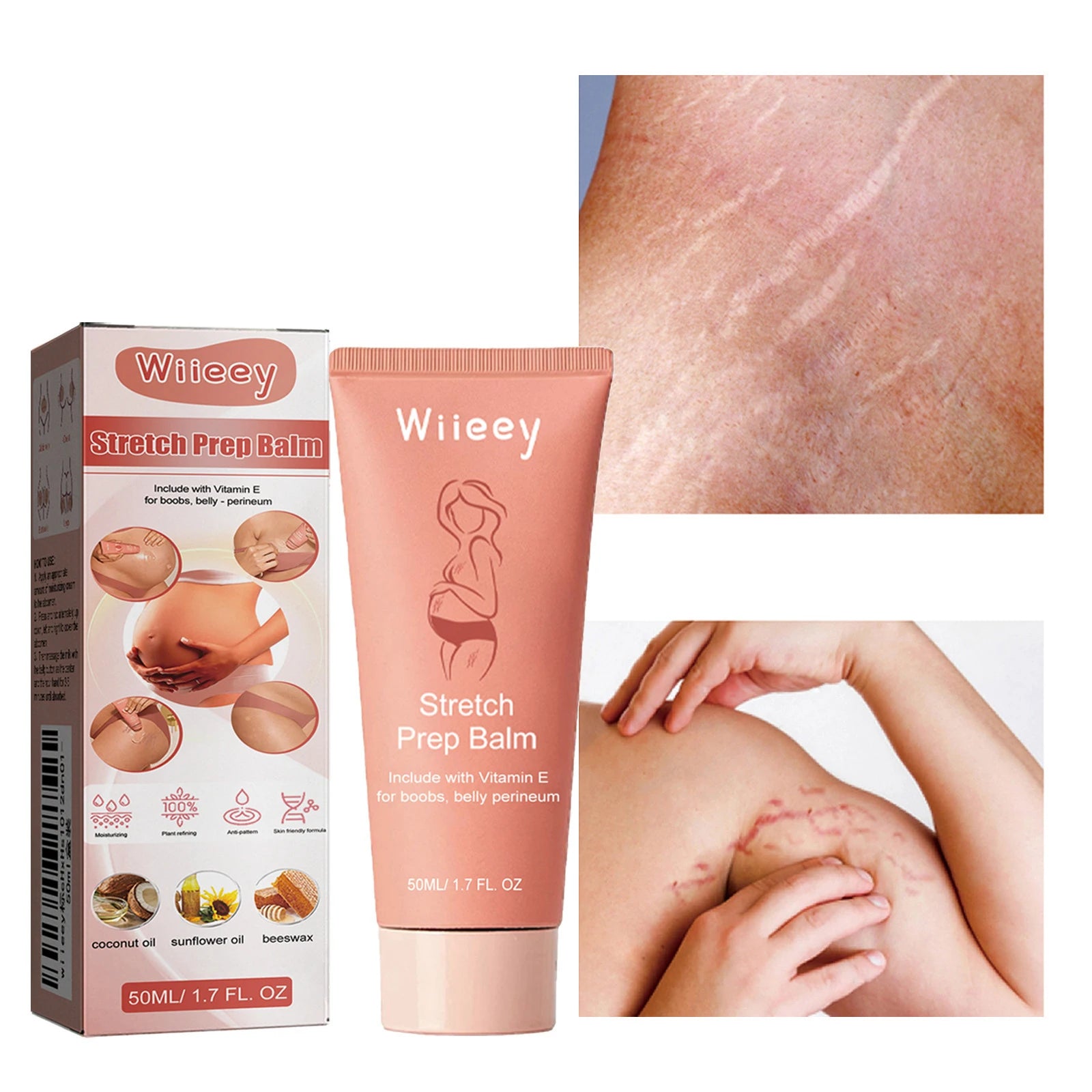 2026 Stretch Mark Removal Cream Permanently Removes Stretch Marks Rejuvenates Skin Stretch Mark Removal Cream.