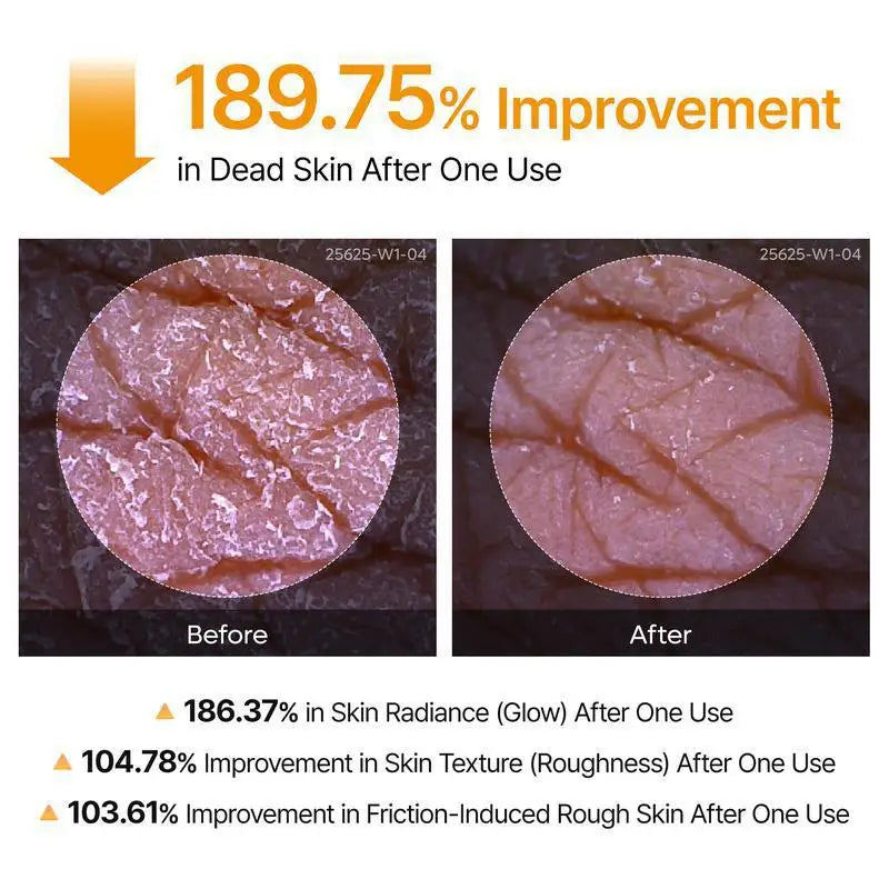 Kojic Acid Turmeric Body Scrub Spray | Natural Exfoliating 200ml Scrubs Treatments Tidesmit