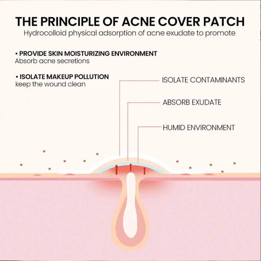200/1000PCS Acne Patch Water Colloidal Patch Acne Patch Covering Facial Flaws Ultra Thin Invisible Suitable For All Skin Types