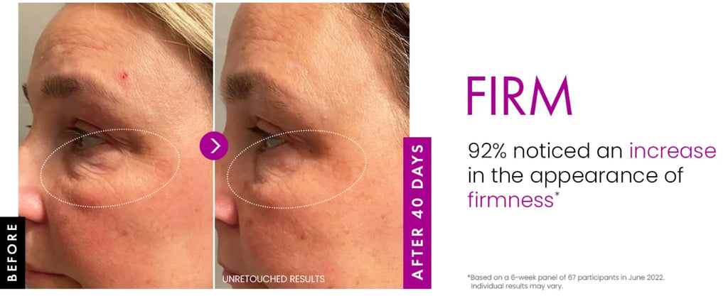 Before and after comparison of skin under eyes showing reduced fine lines and increased firmness after 40 days of use.