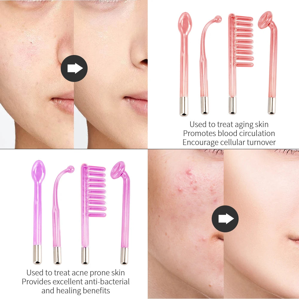 Four glass high-frequency facial electrodes in spoon, curved, comb, and mushroom shapes with skin treatment results.