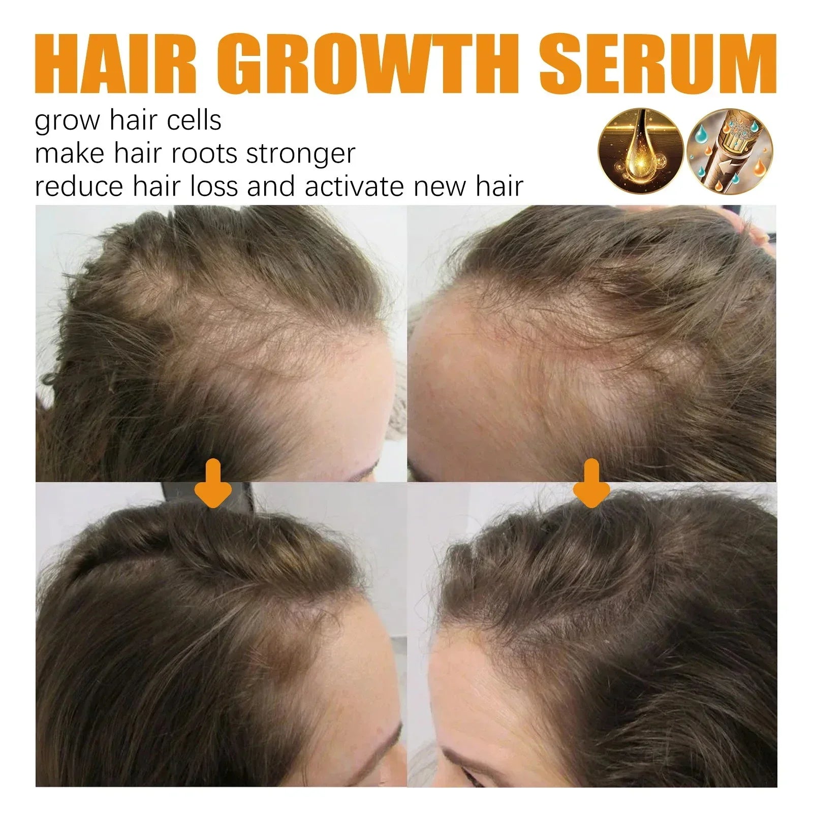 Tidesmit hair growth serum for women: fast regrowth treatment to repair scalp, reduce hair loss, and strengthen roots.