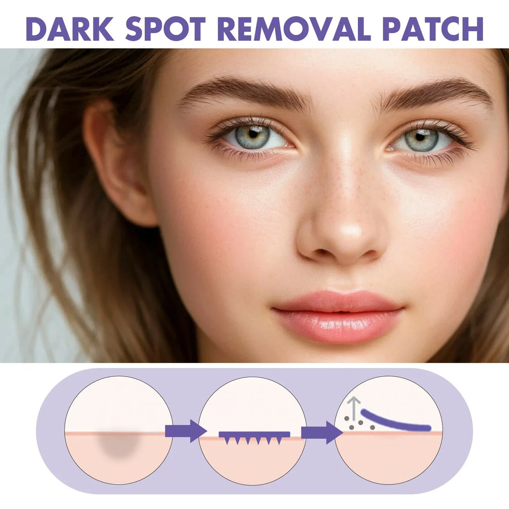 144Pcs Hydrocolloid Acne Acne Patches Invisible Pimple Spot Marks Remover Concealer Cover Stickers Facial Skin Care Treatment