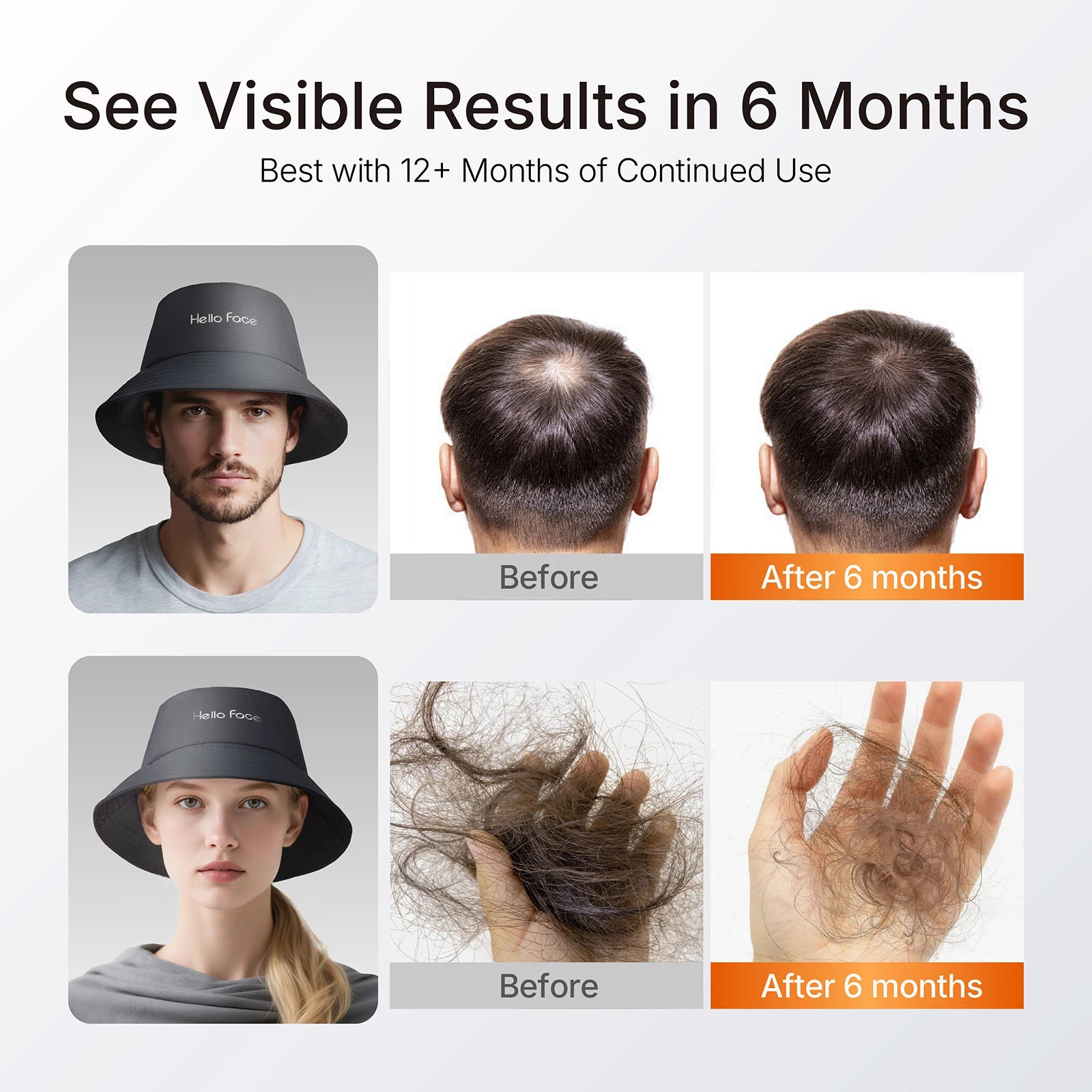 Red Light Therapy Hair Growth Hat, Dual Wavelength LED - Navy Relaxation Treatment Tidesmit