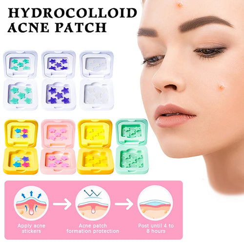 Hydrocolloid acne patch set with mini star stickers in clear plastic cases, assorted colors