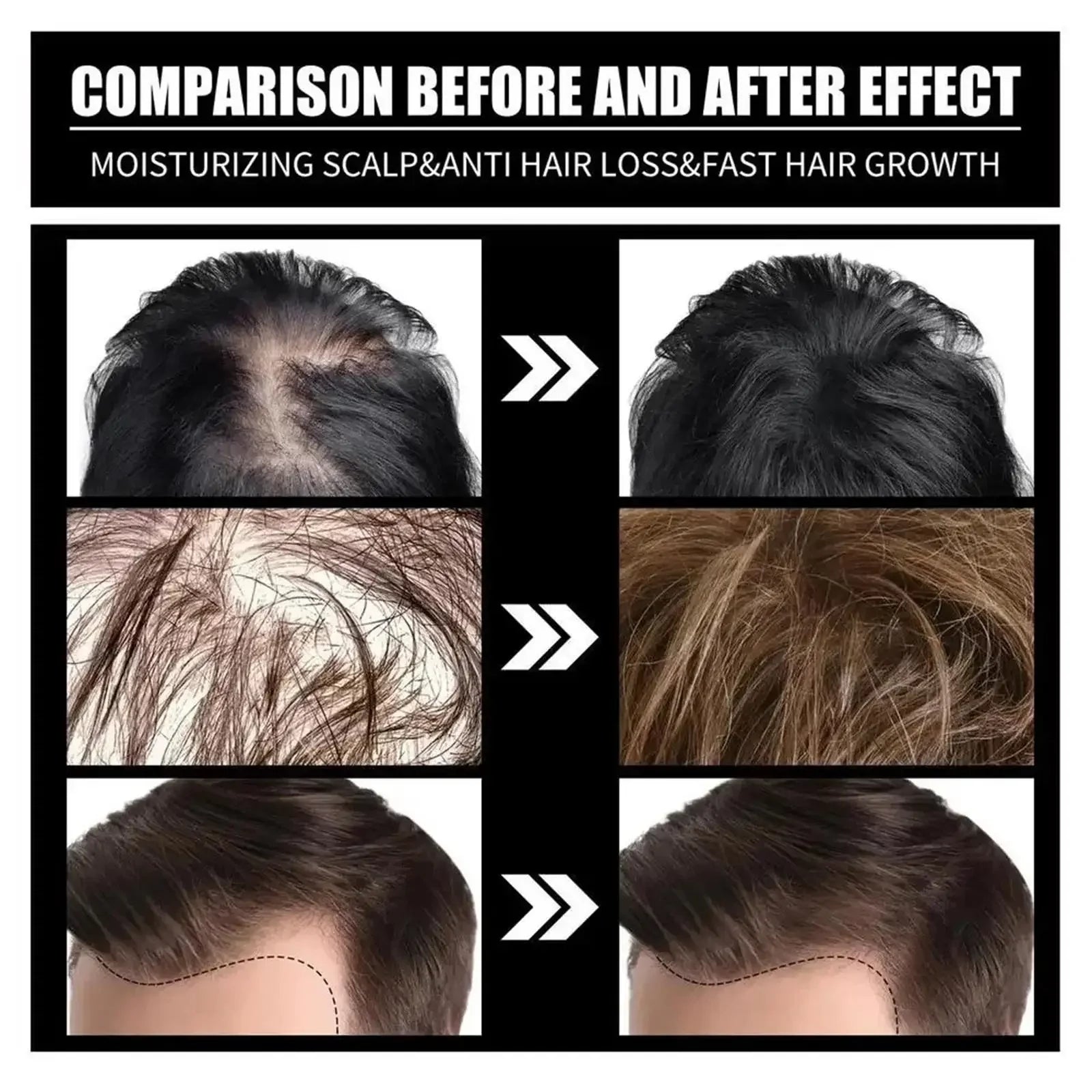 Tidesmit fast hair growth serum before and after results for baldness, scalp repair, and anti-hair loss treatment.
