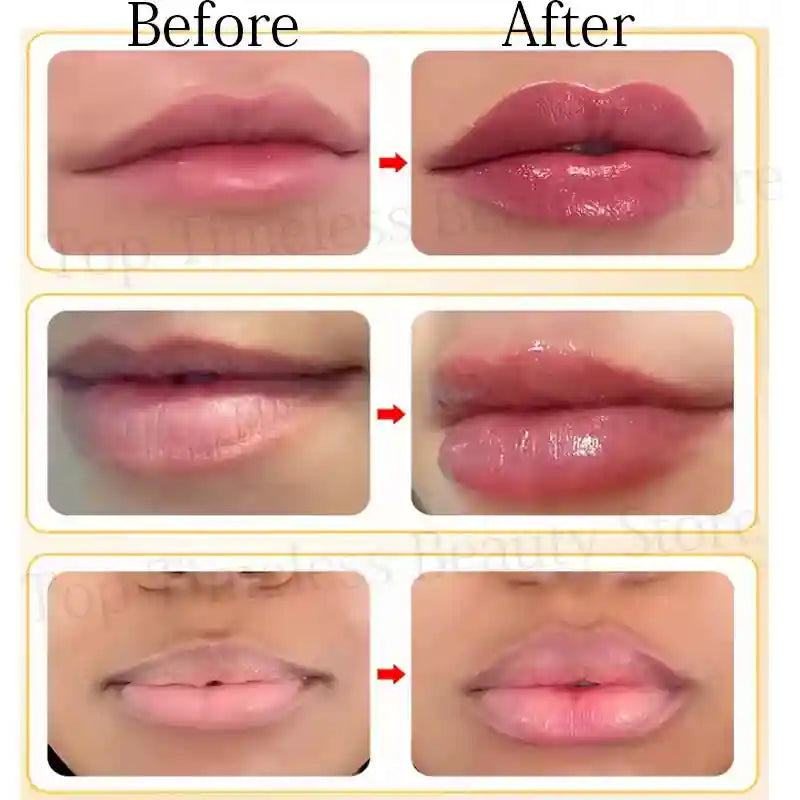 Lip Plumper Serum | Instant Hydrating Lip Treatment for Fuller Lips Lip Care Tidesmit