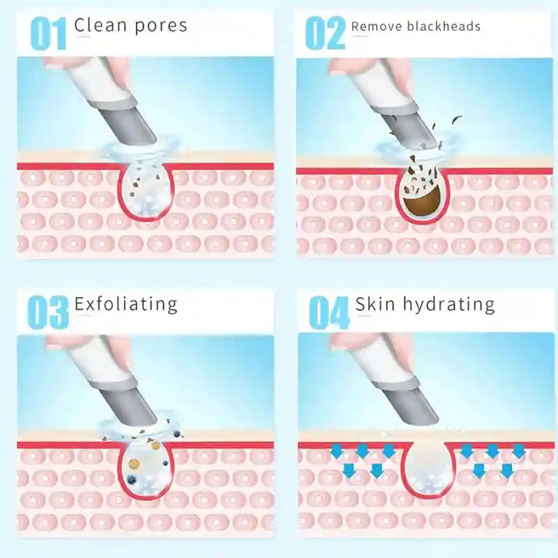 Hydra Facial Machine - Deep Pore Cleansing & Electric Massager Tool Eye Massage Instrument Tidesmit