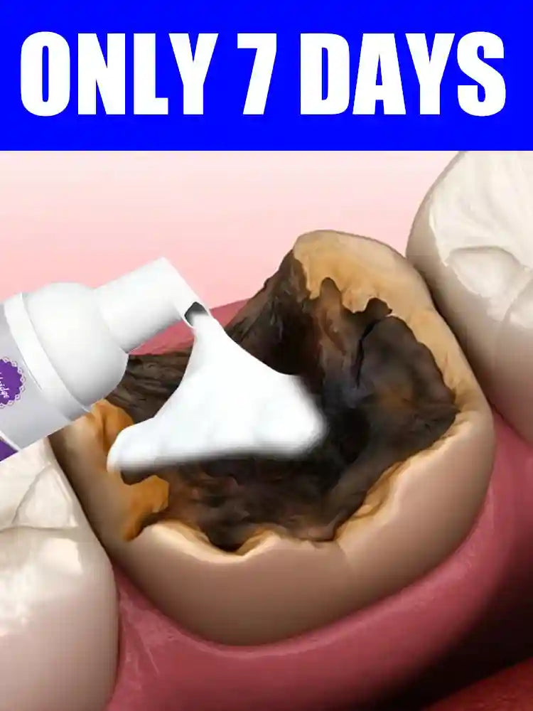 Tidesmit 2025 New 3.0 Teeth Whitening Oral Foam Cleaning Kit
