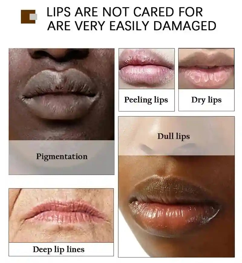 Dark Lip Moisturizing Balm - Targeted Melanin & Line Treatment Lip Care Tidesmit