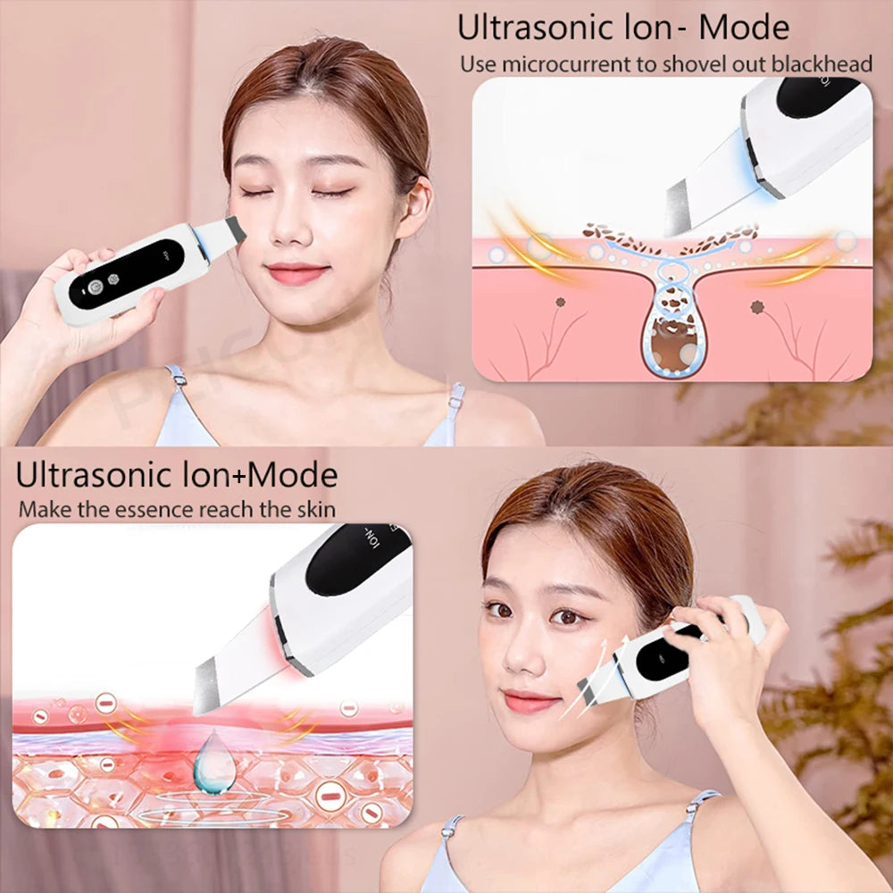 Ultrasonic Skin Scrubber – Professional Pore Cleansing Facial Tool Scrubs Treatments Tidesmit