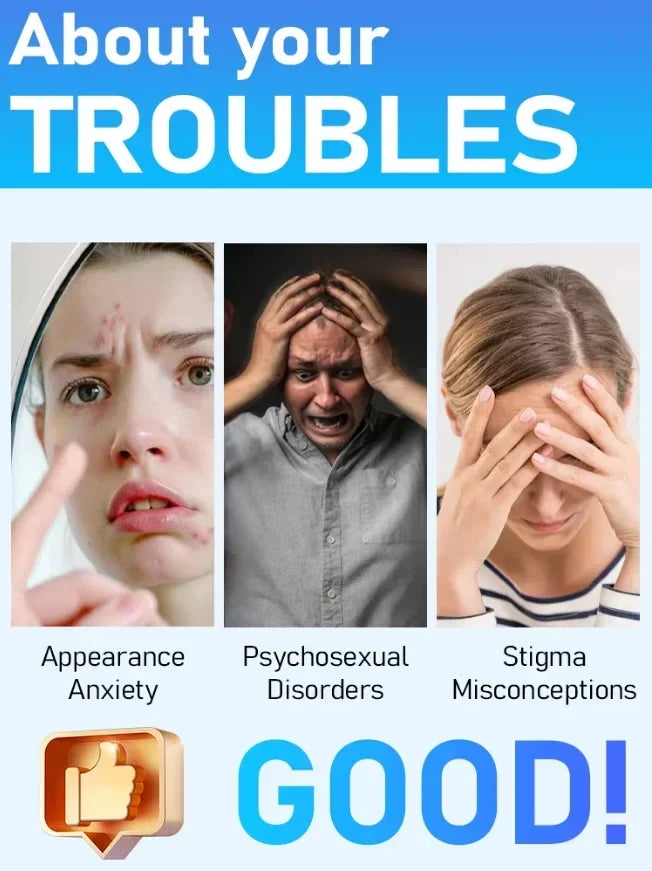 Blue Light Wart Removal Tool - Portable LED Skin Therapy Device Relaxation Treatment Tidesmit