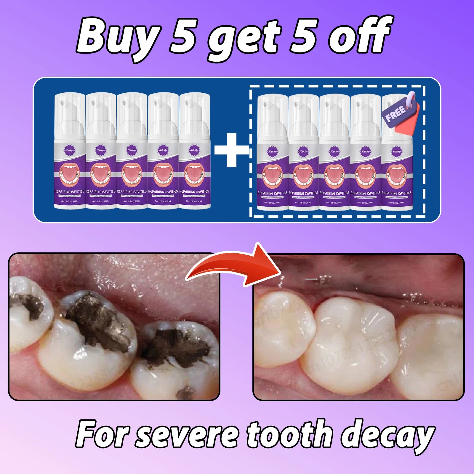 Tidesmit tooth decay repair treatment for cavity protection and teeth whitening