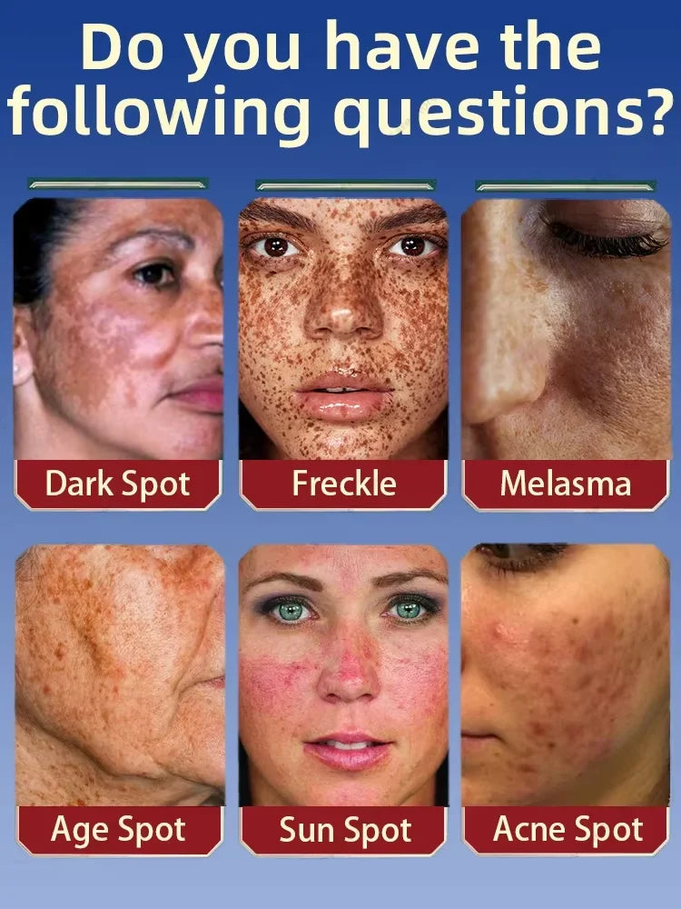 Six facial close-ups showing skin conditions: dark spots, freckles, melasma, age spots, sun spots, and acne spots.