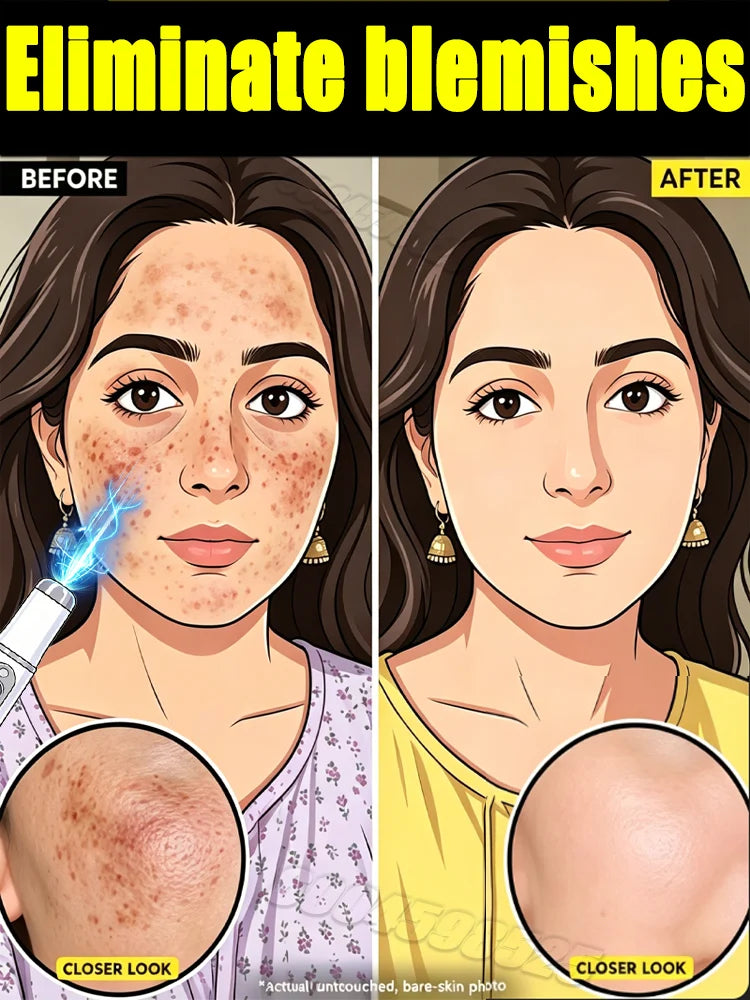 Suitable for everyone, it can help remove dirt from the face.