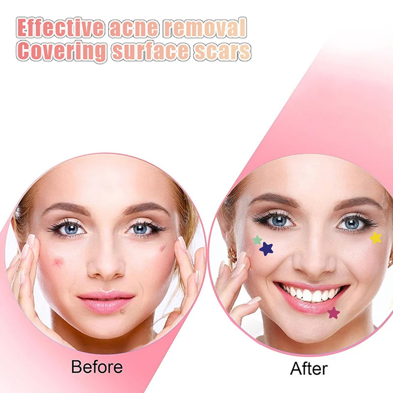 1Box Hydrocolloid Acne Patch Fade Repair Invisible Acne Removal Stickers Concealer Makeup Tool Star With Mirror