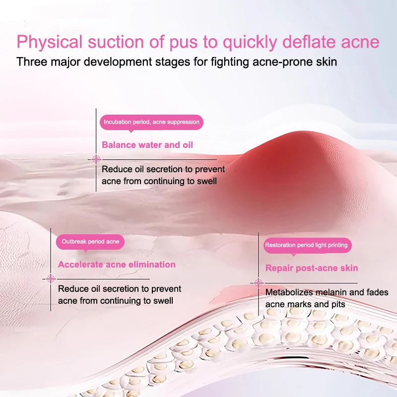 360Pcs Colorful Invisible Pimple Removal Anti-Acne Hydrocolloid Patches Spots Marks Concealer Beauty Makeup Tool Repair Sticker