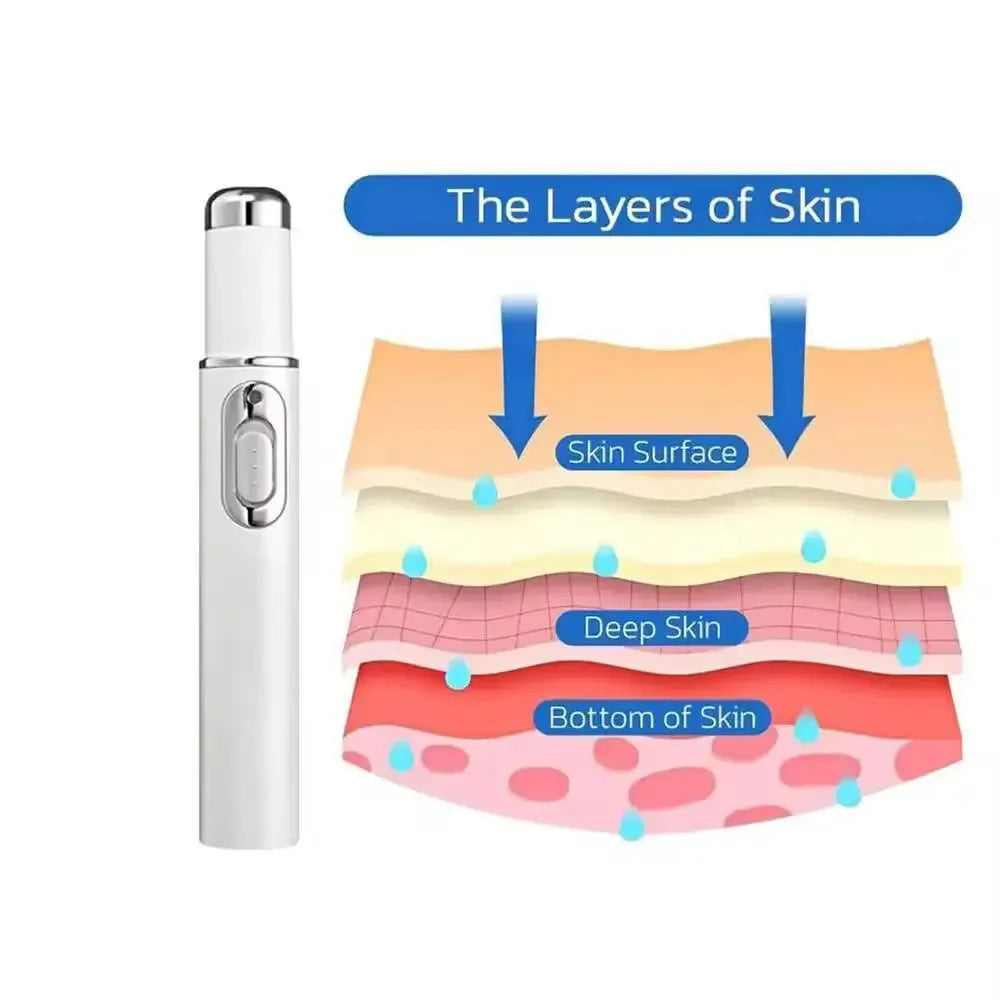 Wart Removal Blue Light Laser Pen - Portable Dermatological Skin Care Lip Care Tidesmit