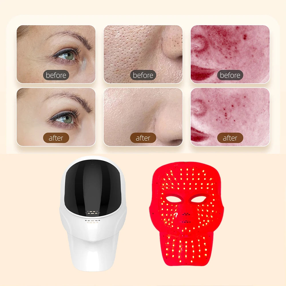 LED beauty mask for face and neck shown in white and glowing red, with before and after skin improvement comparisons.