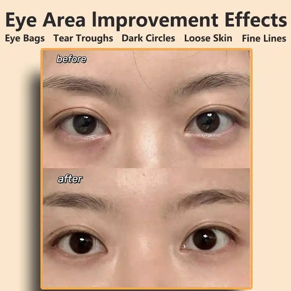 Microcurrent Eye Massager for Facial Lifting and Dark Circles Eye Massage Instrument Tidesmit