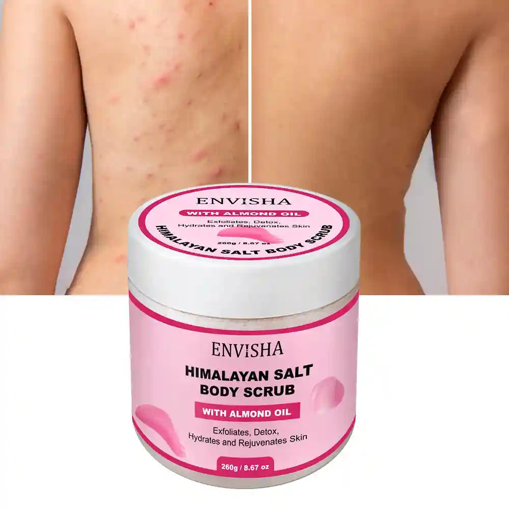 Rose Body Scrub - Natural Exfoliating Moisturizer for Smooth Skin Scrubs Treatments ROSE Tidesmit