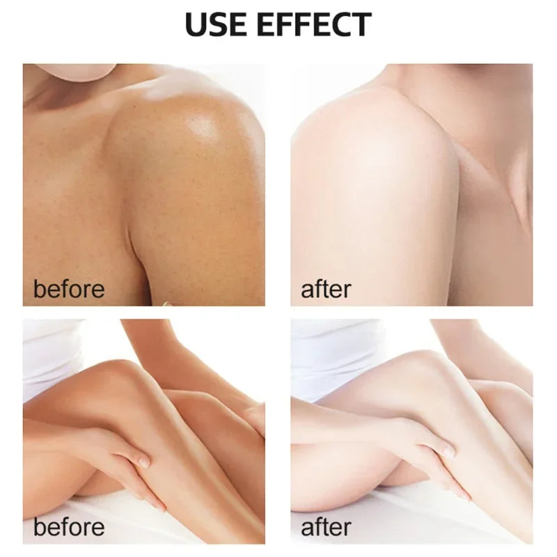 Yellow Peeling Oil for Body Exfoliation - Professional Brightening Serum Scrubs Treatments Tidesmit