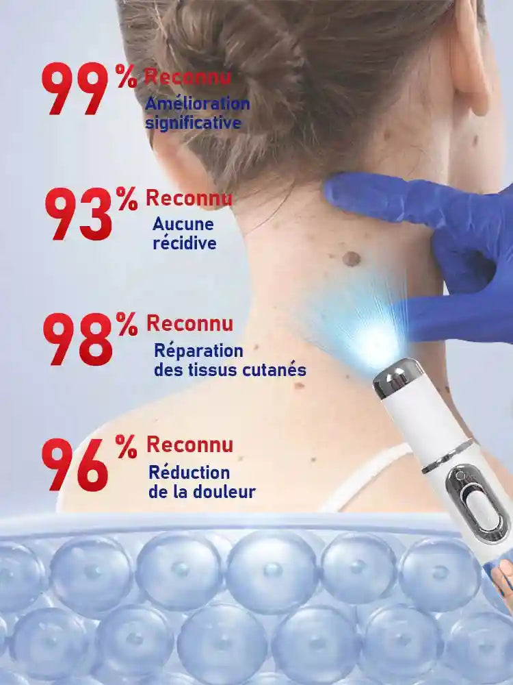 Wart Removal Blue Light Pen: Painless Skin Tag and Lip Care Solution Lip Care Tidesmit
