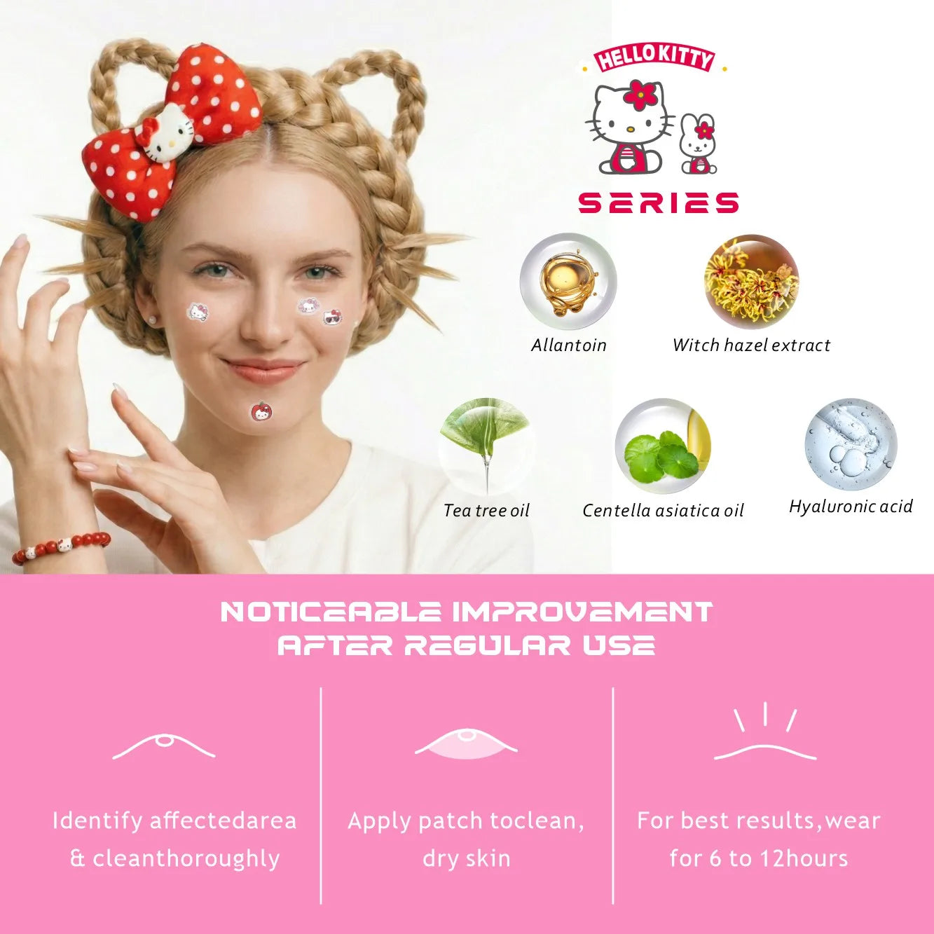 Acne patches, acne stickers, facial acne patches, concealer, concealer stickers 150PCS hello kitty