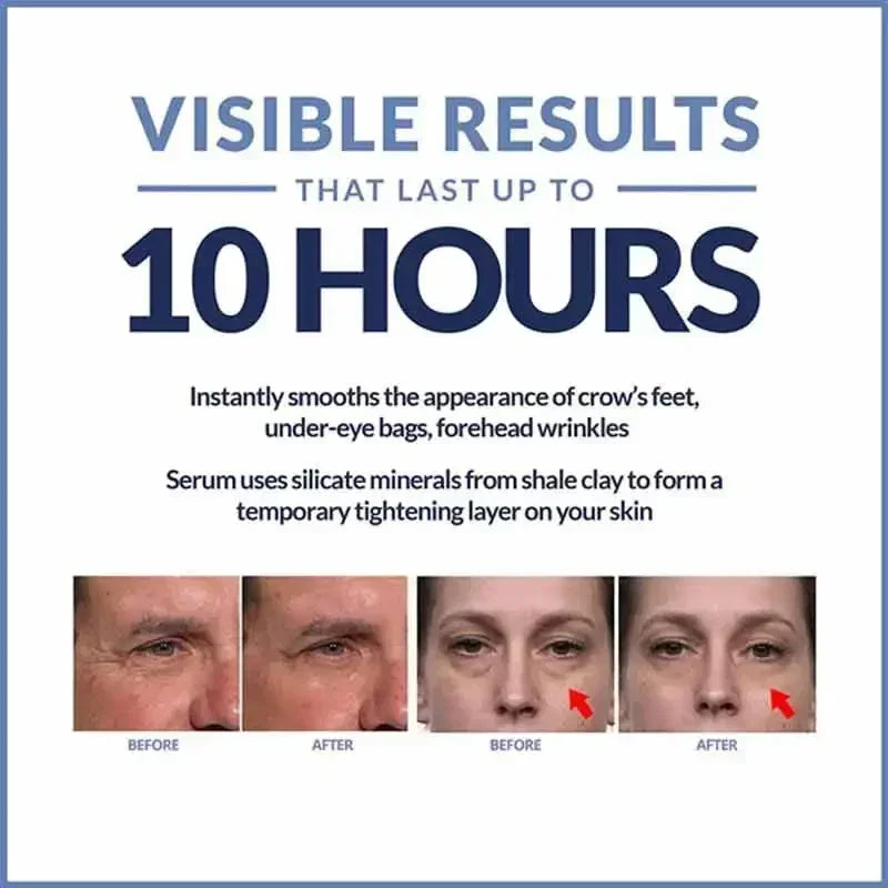 Instant Anti Aging Eye Cream for Dark Circles and Puffiness | Tidesmit Relaxation Treatment Tidesmit