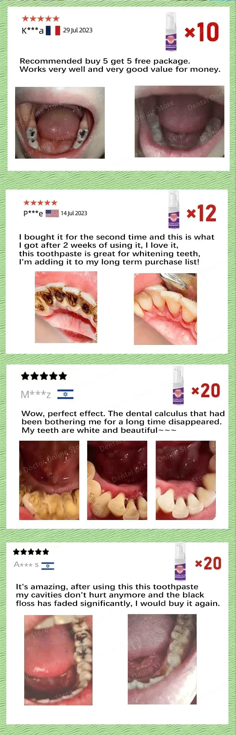 Tidesmit teeth whitening and cavity repair kit for plaque removal and dental enamel protection