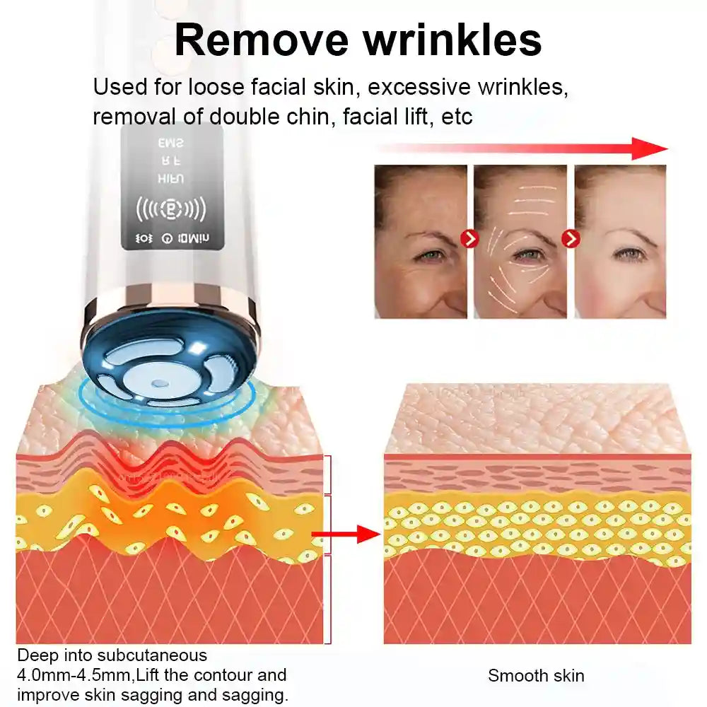 HIFU Face Lifting Machine with EMS Microcurrent & Heat Therapy Eye Massage Instrument Tidesmit