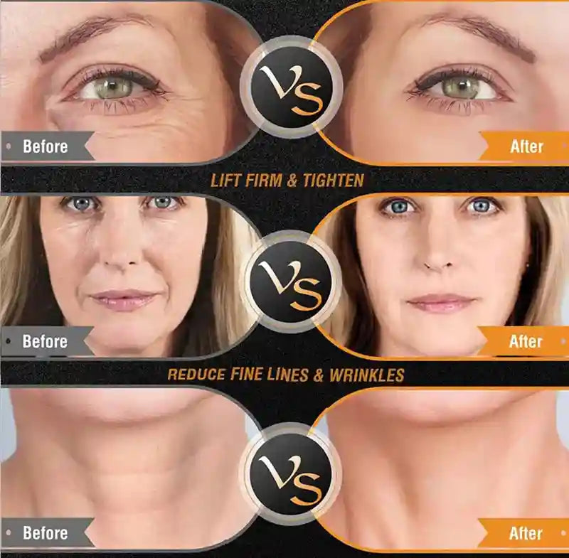 RF Radio Frequency Facial Machine for Skin Tightening - Tidesmit Eye Massage Instrument Tidesmit
