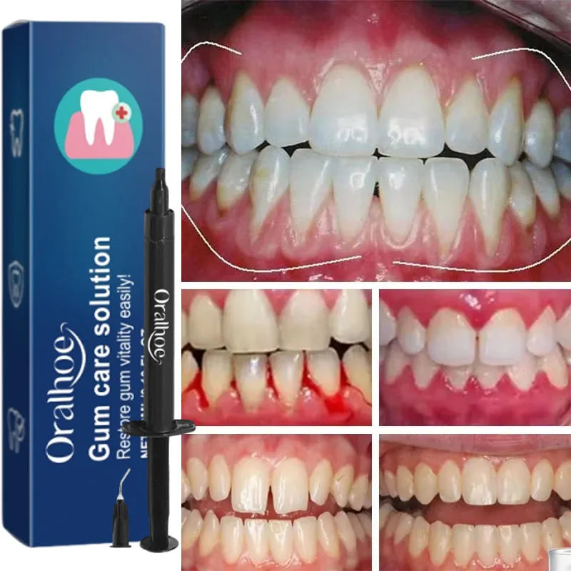 Tidesmit Gum Repair Care teeth whitening gel for treating gingival inflammation and removing dental stains.